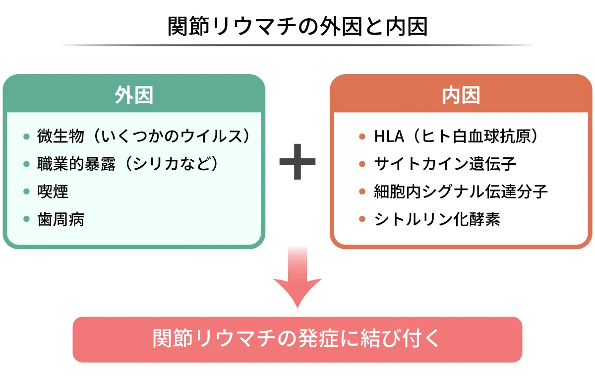 関節リウマチの外因と内因