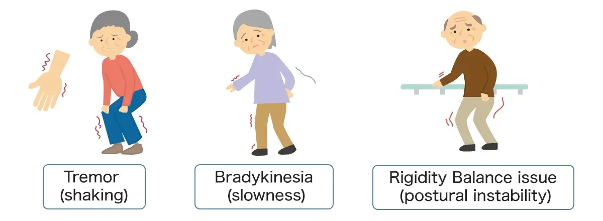 Tremor（shaking） Bradykinesia（slowness）　Rigidity Balance issue（postural instability）